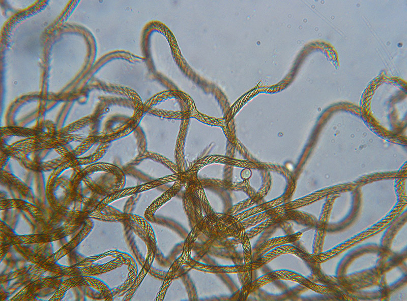 Trichia + Licea?